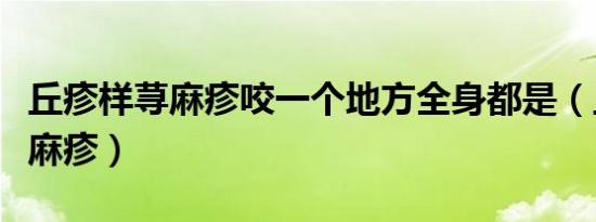 丘疹样荨麻疹咬一个地方全身都是（丘疹样荨麻疹）